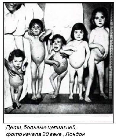 Как родилась безглютеновая диета и почему она важна сегодня