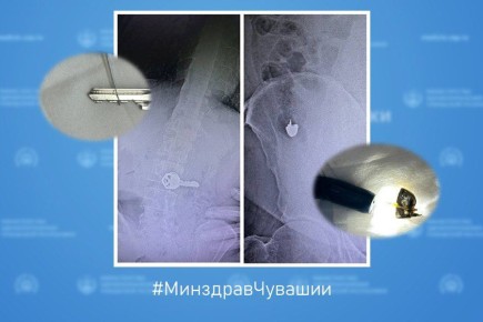 ����������� ���������������� ��������� ��������� ����������� �������� �1 �� ����� �������� �� ������� ��������� ������ ������� � ������� ����