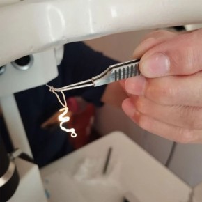 Живого червя длиной 20 см извлекли из глаза пациента в Чебоксарах – причем паразита "поселил" там комар, укусивший мужчину еще летом